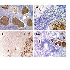 asc2/asci antibody